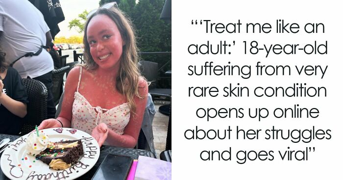 Teen With An Extremely Rare Skin Condition Talks About Her Struggles Online, Ends Up Going Viral