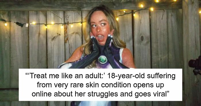 Teen With An Extremely Rare Skin Condition Talks About Her Struggles Online, Ends Up Going Viral