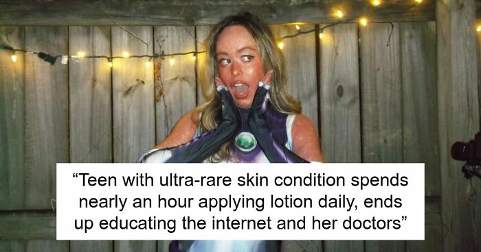 Teen With An Extremely Rare Skin Condition Talks About Her Struggles Online, Ends Up Going Viral