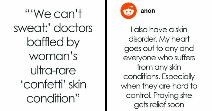 Teen With An Extremely Rare Skin Condition Talks About Her Struggles Online, Ends Up Going Viral