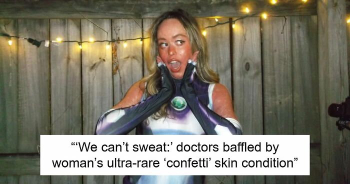 Teen With An Extremely Rare Skin Condition Talks About Her Struggles Online, Ends Up Going Viral
