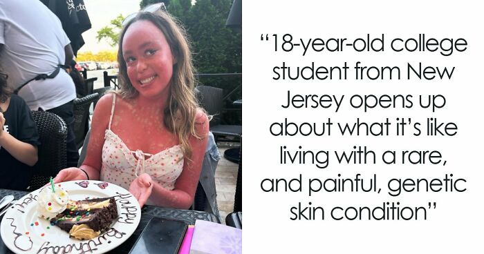 Teen With An Extremely Rare Skin Condition Talks About Her Struggles Online, Ends Up Going Viral