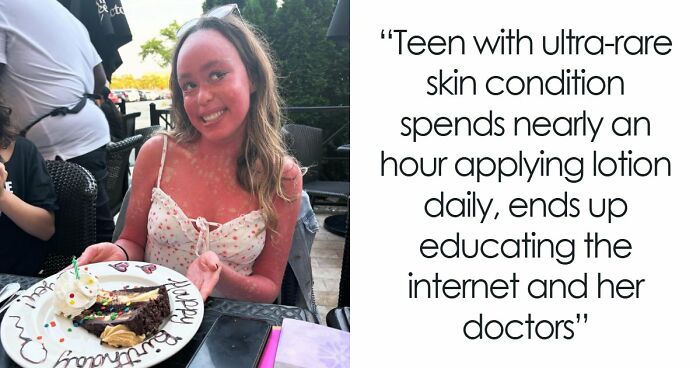 Teen With An Extremely Rare Skin Condition Talks About Her Struggles Online, Ends Up Going Viral