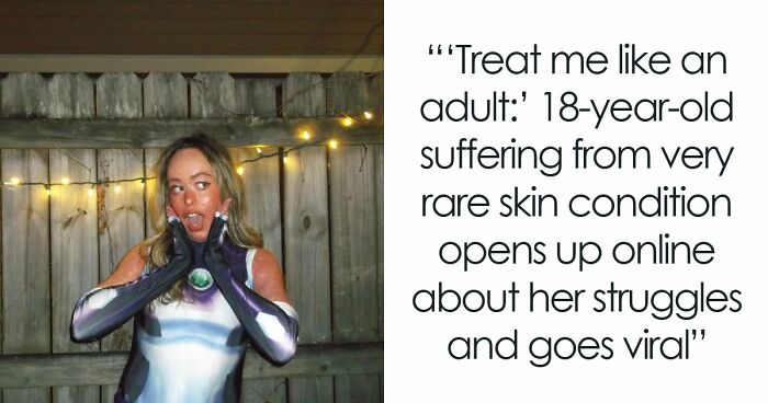 Teen With An Extremely Rare Skin Condition Talks About Her Struggles Online, Ends Up Going Viral