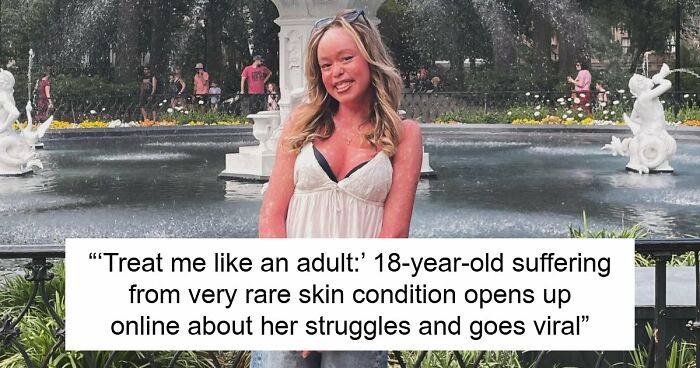Teen With An Extremely Rare Skin Condition Talks About Her Struggles Online, Ends Up Going Viral
