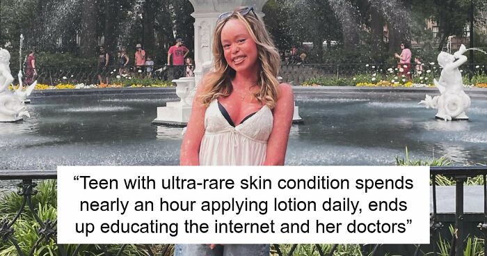 Teen With An Extremely Rare Skin Condition Talks About Her Struggles Online, Ends Up Going Viral