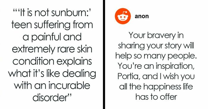 Teen With An Extremely Rare Skin Condition Talks About Her Struggles Online, Ends Up Going Viral