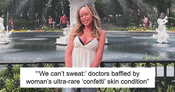 Teen With An Extremely Rare Skin Condition Talks About Her Struggles Online, Ends Up Going Viral