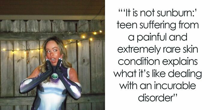 Teen With An Extremely Rare Skin Condition Talks About Her Struggles Online, Ends Up Going Viral