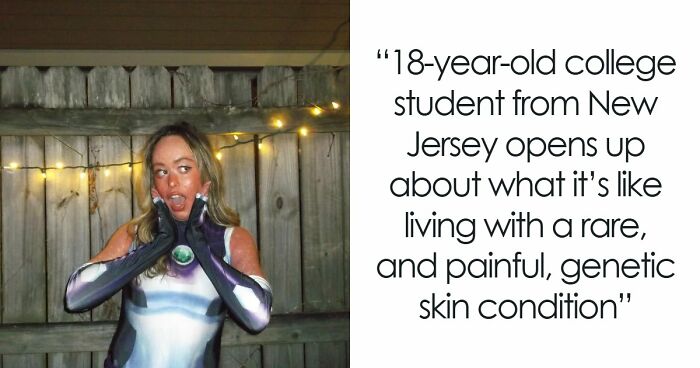 Teen With An Extremely Rare Skin Condition Talks About Her Struggles Online, Ends Up Going Viral