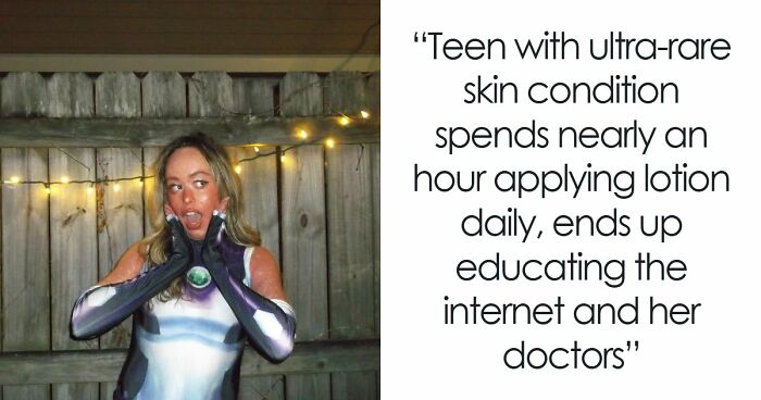 Teen With An Extremely Rare Skin Condition Talks About Her Struggles Online, Ends Up Going Viral