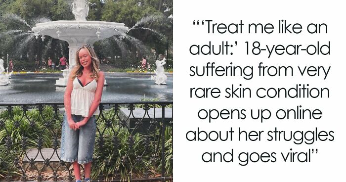 Teen With An Extremely Rare Skin Condition Talks About Her Struggles Online, Ends Up Going Viral