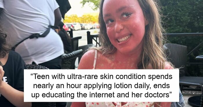 Teen With An Extremely Rare Skin Condition Talks About Her Struggles Online, Ends Up Going Viral