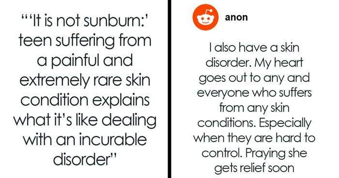 Teen With An Extremely Rare Skin Condition Talks About Her Struggles Online, Ends Up Going Viral