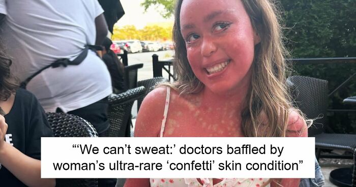 Teen With An Extremely Rare Skin Condition Talks About Her Struggles Online, Ends Up Going Viral