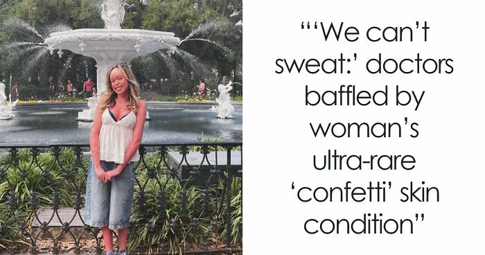 Teen With An Extremely Rare Skin Condition Talks About Her Struggles Online, Ends Up Going Viral