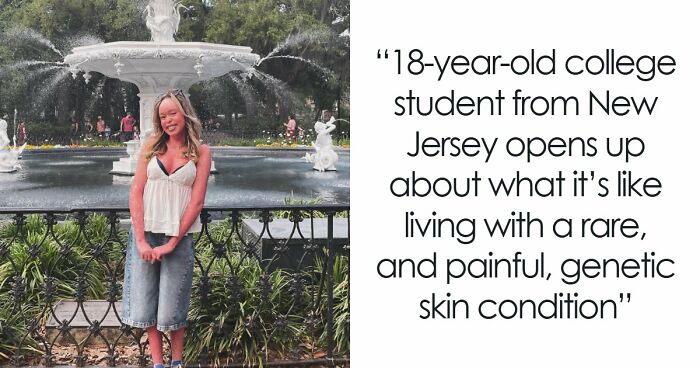 Teen With An Extremely Rare Skin Condition Talks About Her Struggles Online, Ends Up Going Viral