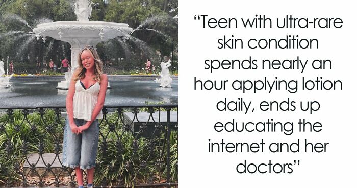 Teen With An Extremely Rare Skin Condition Talks About Her Struggles Online, Ends Up Going Viral