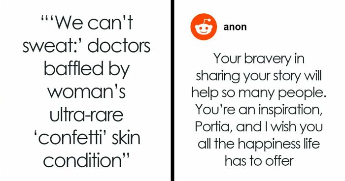 Teen With An Extremely Rare Skin Condition Talks About Her Struggles Online, Ends Up Going Viral