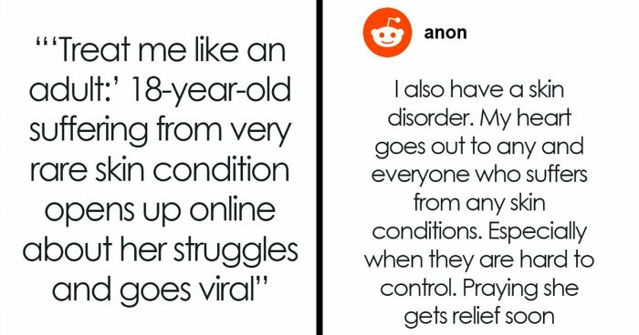 Teen With An Extremely Rare Skin Condition Talks About Her Struggles Online, Ends Up Going Viral