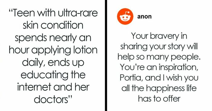 Teen With An Extremely Rare Skin Condition Talks About Her Struggles Online, Ends Up Going Viral