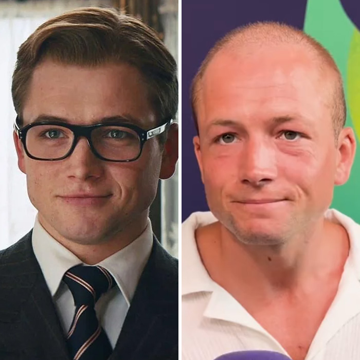 Before and after photos showing men's aging and hair loss