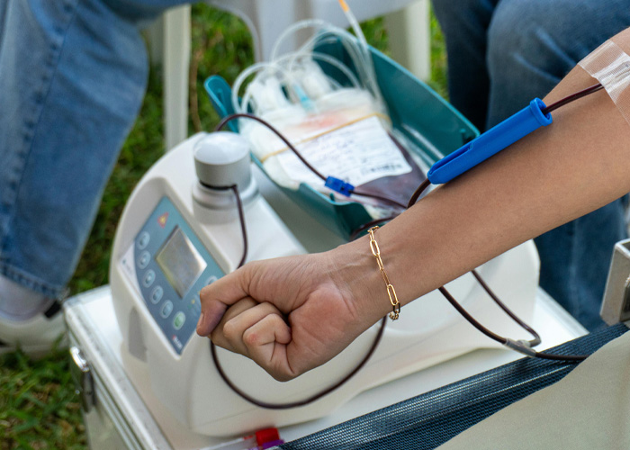 Close-up of arm receiving dialysis treatment with medical tubing Close-up of arm receiving dialysis treatment with medical tubing
