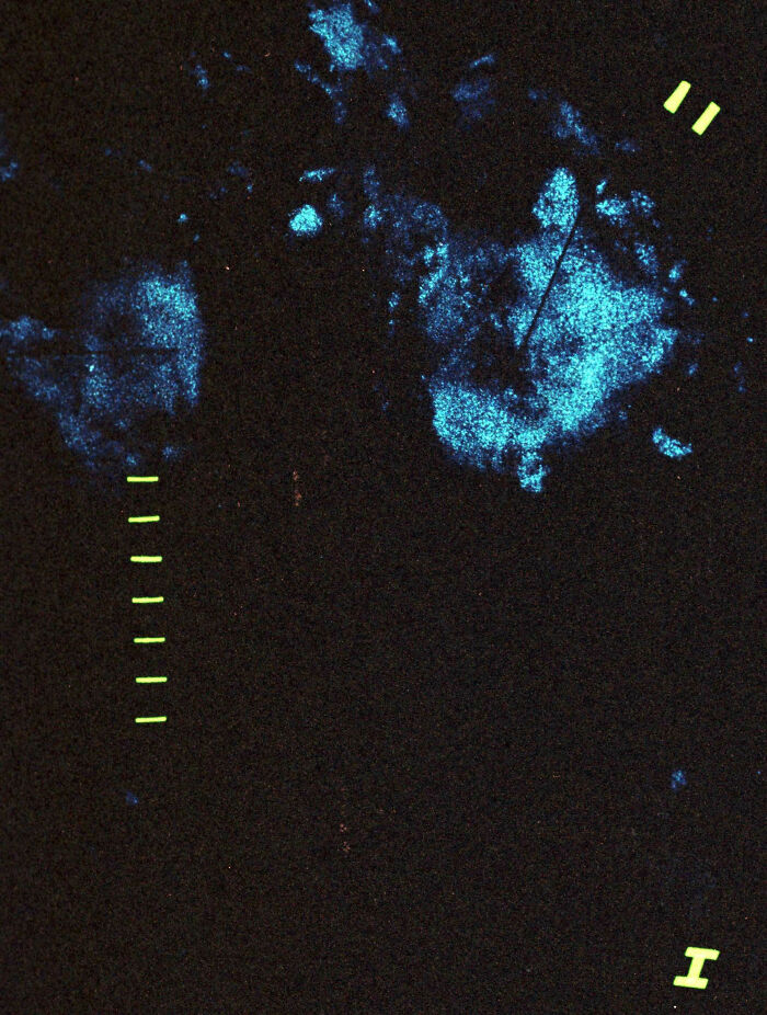 Creepy microscopic image showing stained cells in blue