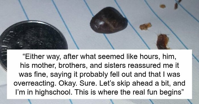 Guy Carries A Rock In His Ear For 13 Years, Finally Pulls It Out Himself After Doctors Fail
