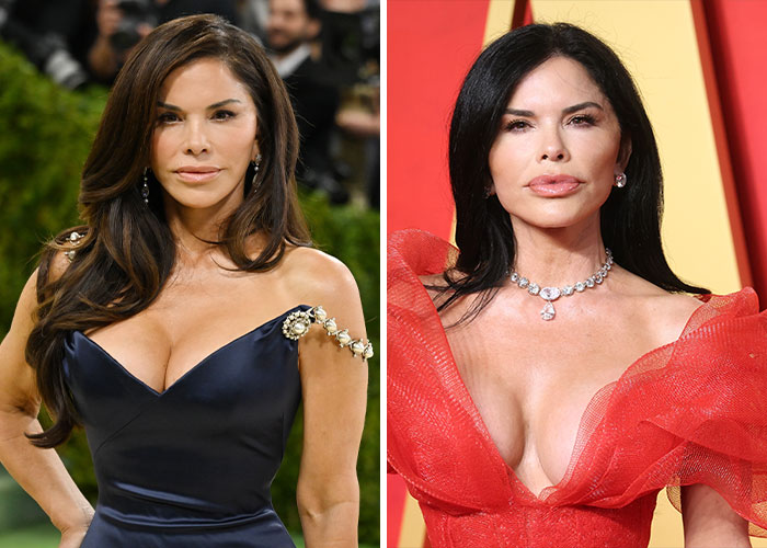 A woman before and after plastic surgery at the Met Gala. Her appearance has notably changed due to cosmetic procedures.