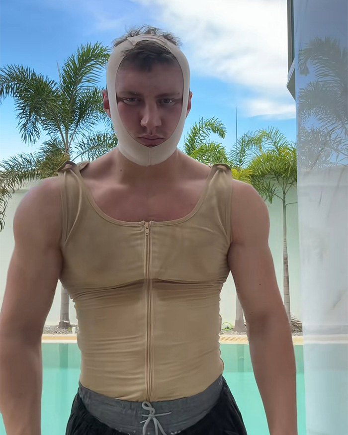 Looksmaxxer man wearing compression garment by pool outdoors