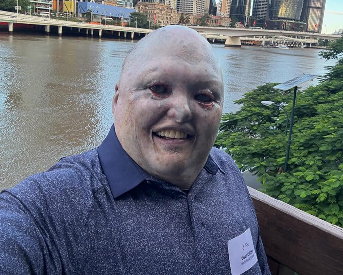 Man Has Inspiring Response After Meta AI's 'Appalling' Insult Results In Barrage Of Trolls