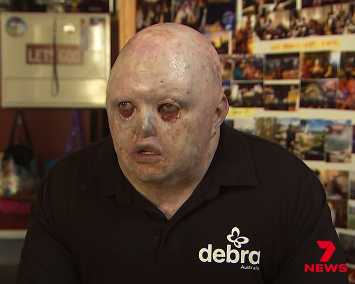 Man Has Inspiring Response After Meta AI's 'Appalling' Insult Results In Barrage Of Trolls