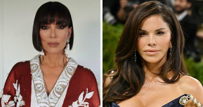 Met Gala 2026 Was More About Plastic Surgery Than Fashion As Stars Showed Off Their Procedures