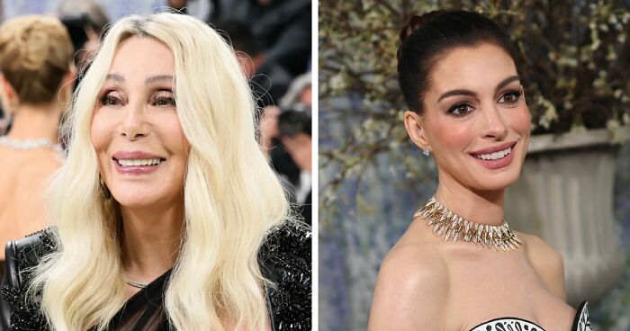 Met Gala 2026 Was More About Plastic Surgery Than Fashion As Stars Showed Off Their Procedures