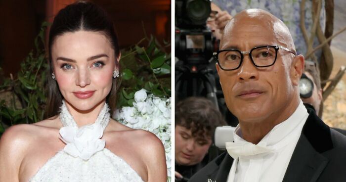 Met Gala 2026 Was More About Plastic Surgery Than Fashion As Stars Showed Off Their Procedures