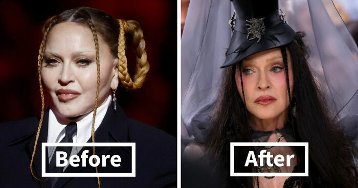 Met Gala 2026 Was More About Plastic Surgery Than Fashion As Stars Showed Off Their Procedures