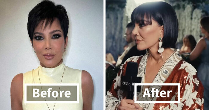 Met Gala 2026 Was More About Plastic Surgery Than Fashion As Stars Showed Off Their Procedures