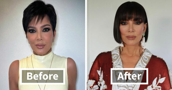 Met Gala 2026 Was More About Plastic Surgery Than Fashion As Stars Showed Off Their Procedures