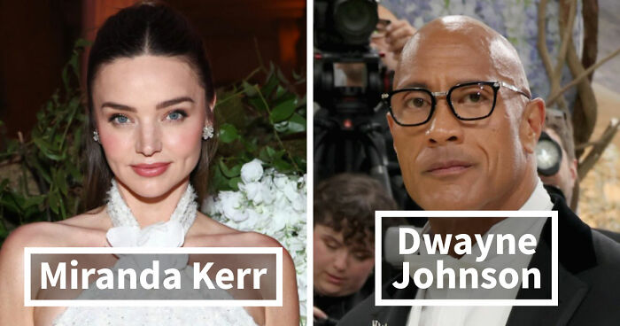 Met Gala 2026 Was More About Plastic Surgery Than Fashion As Stars Showed Off Their Procedures