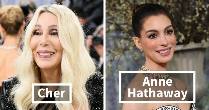 Met Gala 2026 Was More About Plastic Surgery Than Fashion As Stars Showed Off Their Procedures