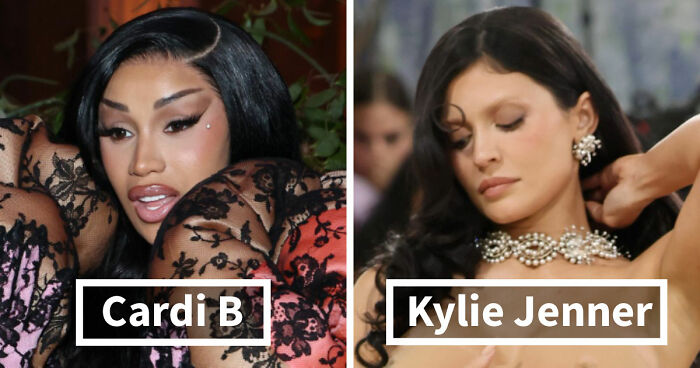 Met Gala 2026 Was More About Plastic Surgery Than Fashion As Stars Showed Off Their Procedures