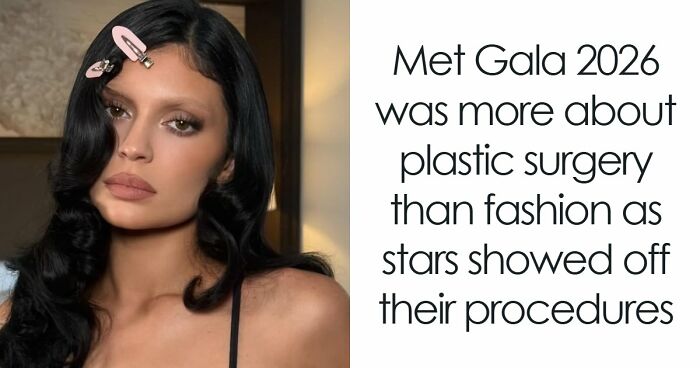 Met Gala 2026 Was More About Plastic Surgery Than Fashion As Stars Showed Off Their Procedures