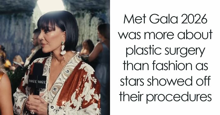 Met Gala 2026 Was More About Plastic Surgery Than Fashion As Stars Showed Off Their Procedures