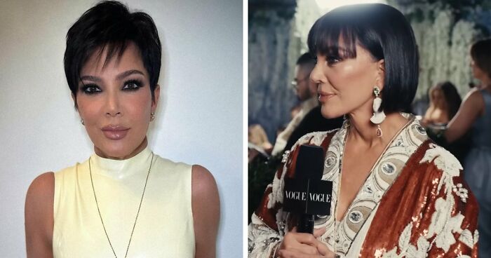 Met Gala 2026 Was More About Plastic Surgery Than Fashion As Stars Showed Off Their Procedures