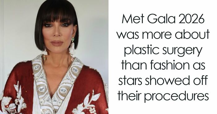 Met Gala 2026 Was More About Plastic Surgery Than Fashion As Stars Showed Off Their Procedures