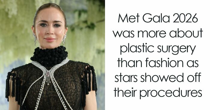 Met Gala 2026 Was More About Plastic Surgery Than Fashion As Stars Showed Off Their Procedures