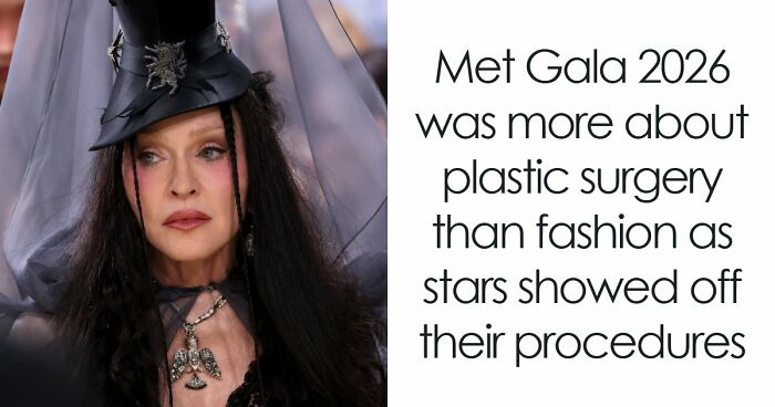 Met Gala 2026 Was More About Plastic Surgery Than Fashion As Stars Showed Off Their Procedures
