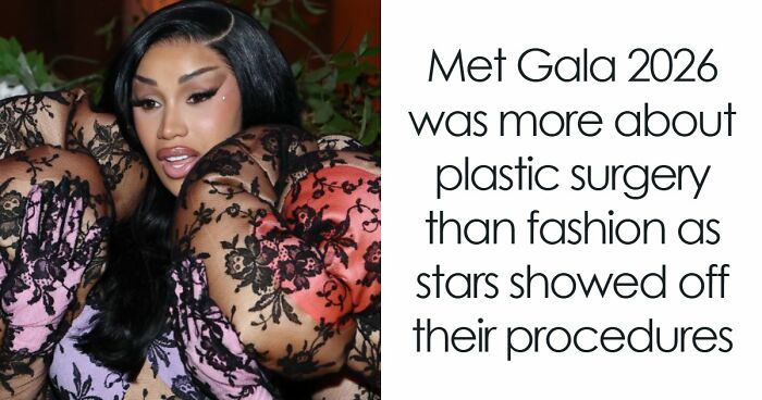 Met Gala 2026 Was More About Plastic Surgery Than Fashion As Stars Showed Off Their Procedures