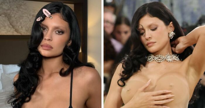 Met Gala 2026 Was More About Plastic Surgery Than Fashion As Stars Showed Off Their Procedures